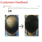 Sevich 100g Hair Fibers Refill Bag 10 Colors Keratin Hair Building Fiber Powder Instant Hair Growth Fiber Powder Anti-Hair Loss