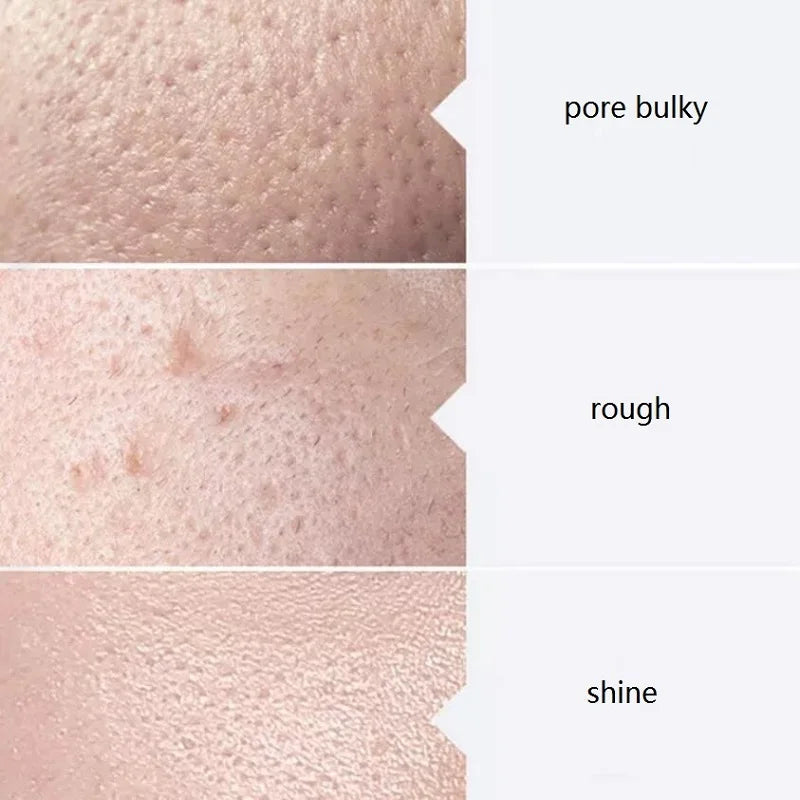 AS1 SA2 AO3 30ml High Concentrated Solution Liquid For  Dermabrasion Beauty Machine Kit of 3 Serums Skin Deep Cleaning Skin Care