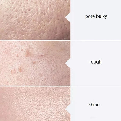 AS1 SA2 AO3 30ml High Concentrated Solution Liquid For  Dermabrasion Beauty Machine Kit of 3 Serums Skin Deep Cleaning Skin Care