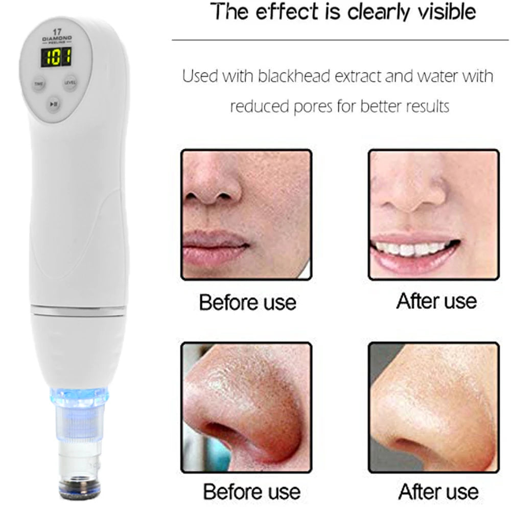 Diamond dermabrasion skin peeling beauty machine vacuum blackhead acne remove face cleaning facial Pore Cleaner equipment