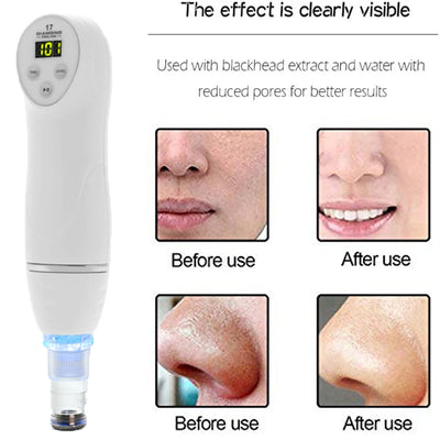 Diamond dermabrasion skin peeling beauty machine vacuum blackhead acne remove face cleaning facial Pore Cleaner equipment