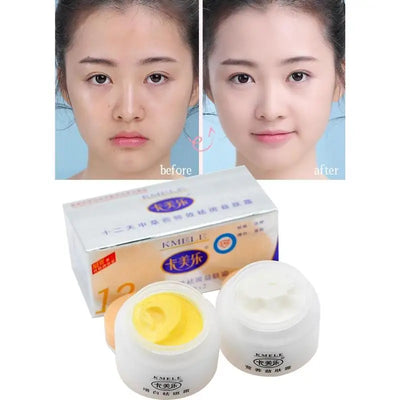 Original Kmele Whitening Cream Face Cream Moisturizing Cream Freckle Care Fade Repare Remover Bottles Skin Freckles 2 Set V7I0