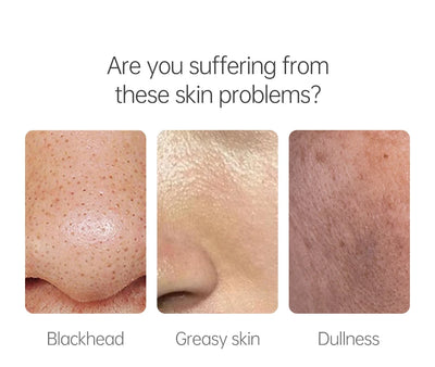 JoyPretty Vitamin C Facial Cleanser Oil Control Exfoliates Deep Cleaning Moisturizing Face Skin Care Cosmetics