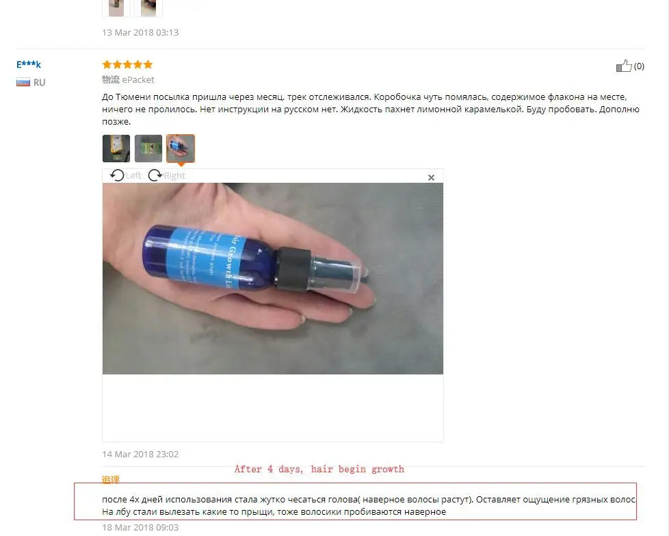 Ginger Hair Growth Essence Yuda Pilatory Stop Hair Loss Fast Hair Growth Products for Men and Woman  Grow Restoration 30ml