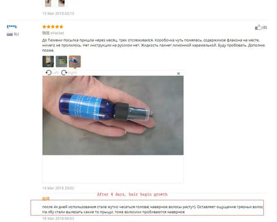 Ginger Hair Growth Essence Yuda Pilatory Stop Hair Loss Fast Hair Growth Products for Men and Woman  Grow Restoration 30ml