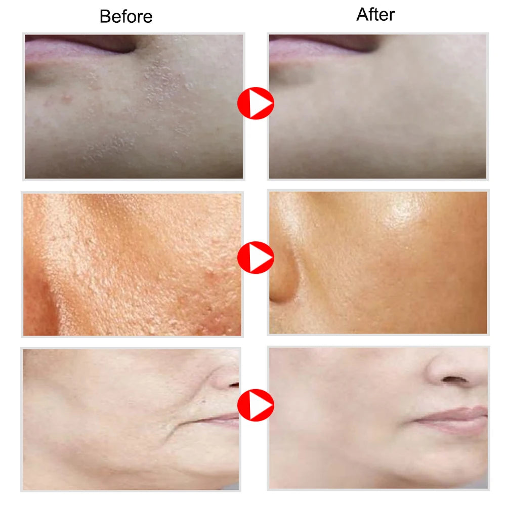 Retinol Snail Aloe Face Cream Anti-Wrinkle Whitening Moisturizing Anti-Aging Facial Day Night Cream Skin Care  Korean Cosmetics