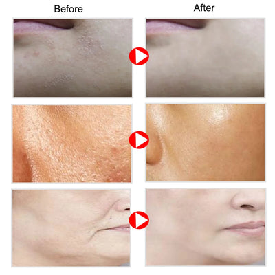 Retinol Snail Aloe Face Cream Anti-Wrinkle Whitening Moisturizing Anti-Aging Facial Day Night Cream Skin Care  Korean Cosmetics