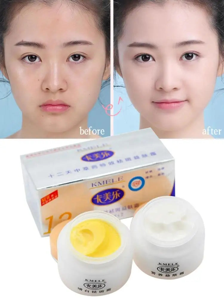 Original Kmele Whitening Cream Face Cream Moisturizing Cream Freckle Care Fade Repare Remover Bottles Skin Freckles 2 Set V7I0