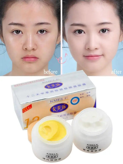 Original Kmele Whitening Cream Face Cream Moisturizing Cream Freckle Care Fade Repare Remover Bottles Skin Freckles 2 Set V7I0
