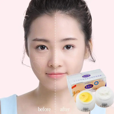 Original Kmele Whitening Cream Face Cream Moisturizing Cream Freckle Care Fade Repare Remover Bottles Skin Freckles 2 Set V7I0