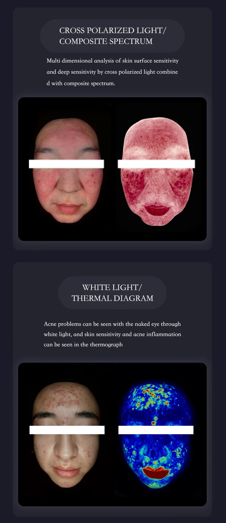 Q1 3D AI Facial Skin Analyzer Detection Skin Problem Diagnosis 8 Spectrum Professional Analysis Beauty Salon Equipment