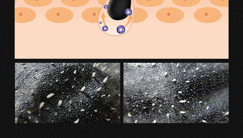Black Head Remover Face Mask Bamboo Charcoal Black Dot T-zone Deep Cleaning for Women Men Blackhead Facial Skin Care Products