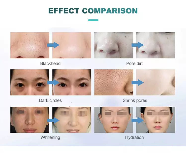 7 In 1 Water Oxygen Bubble Jet Peel Beauty Skin Multifunction Facial Care Machine Peeling Anti Aging Skin Analysis Devices