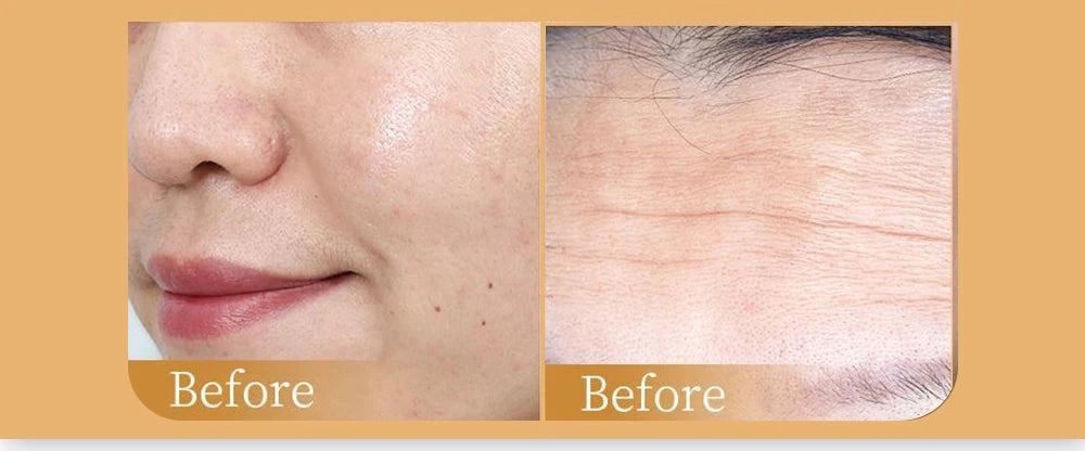 1/5/10/20pcs Collagen Facial Mask Moisturizing Brightening Lifting Skincare Treatment Face Masks Kit