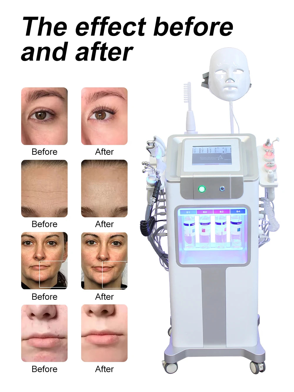 AOKO New 12 IN1 Hydro Dermabrasion Aqua Peeling Ultrasound Facial Care Oxygen Injection Skin Rejuvenation Whiting Beauty Machine