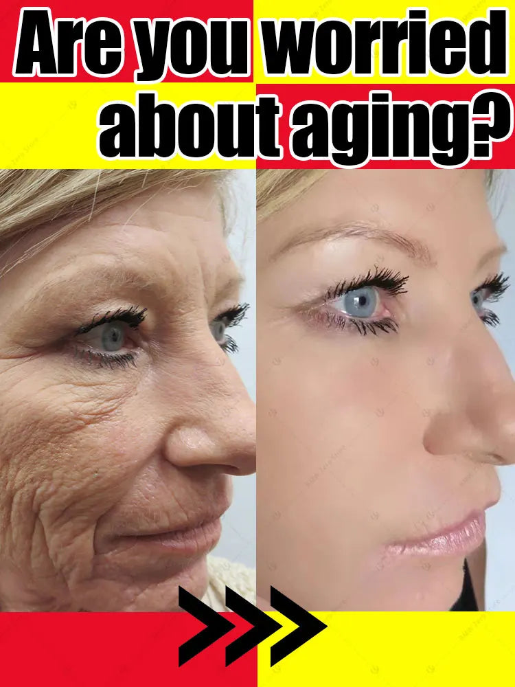 20 years younger, 100% wrinkles disappear