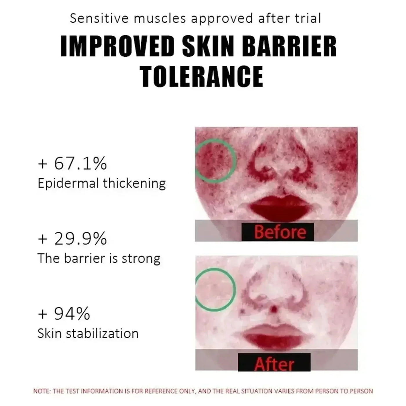 Fast Repair Facial Redness Essential oil Soothing Red Blood Rosacea Improve Sensitive Skin Dryness Moisturizing Korean Cosmetics