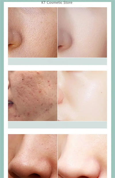 Black White Rice Peel Shot Glow Rice Ampoule Duo Exfoliate Dead Skin Closed Pimples Moisturize Brighten Smooth Pores Care Korea