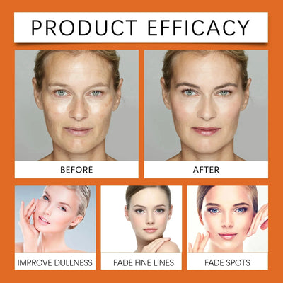 Vitamin C Whitening Serum Remove Freckles Dark Spots Face Essence Fade Melasma Melanin Brighten Repair Dull Skin Care Cosmetics