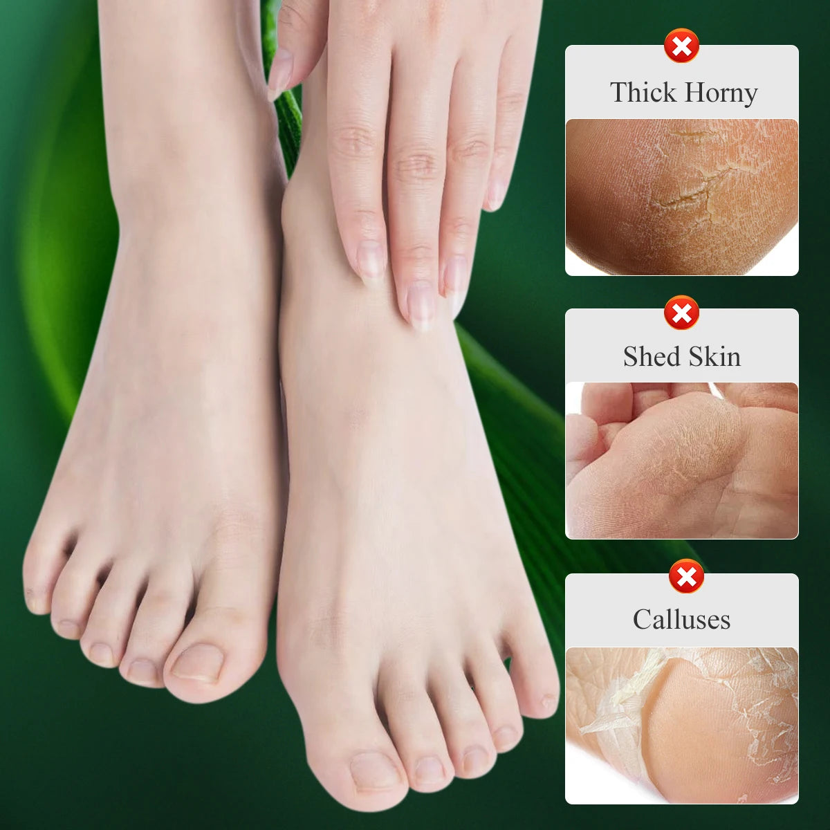 MABREM Foot Treatment Cream Whitening Anti-cracking Moisturizing Foot Care Exfoliating Scrub Anti-dry Calendula Olive Repair 40g