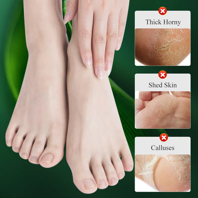 MABREM Foot Treatment Cream Whitening Anti-cracking Moisturizing Foot Care Exfoliating Scrub Anti-dry Calendula Olive Repair 40g