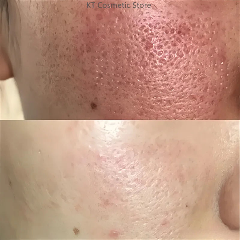 Black White Rice Peel Shot Glow Rice Ampoule Duo Exfoliate Dead Skin Closed Pimples Moisturize Brighten Smooth Pores Care Korea