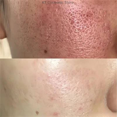 Black White Rice Peel Shot Glow Rice Ampoule Duo Exfoliate Dead Skin Closed Pimples Moisturize Brighten Smooth Pores Care Korea