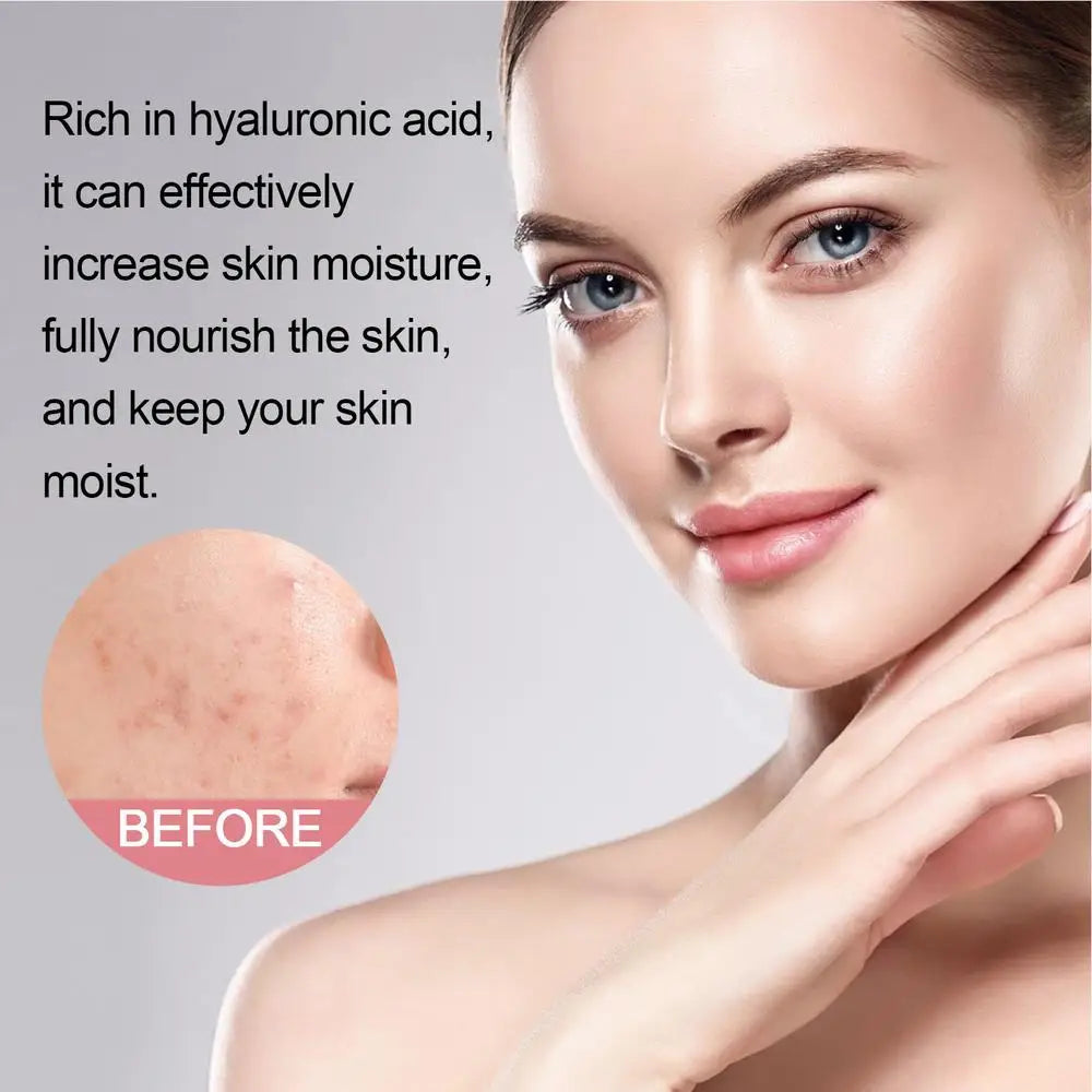 Facial foaming Cleanser Deeply Cleansing Oil Control Moisturizing Blackhead Removal Skin Care Face Wash Foam Cleanser