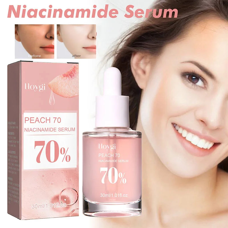 Niacinamide Serum Brightening Complexion Nourishing Hydrating Rejuvenating Serum Pore Contouring Hyaluronic Acid Soothing Skin