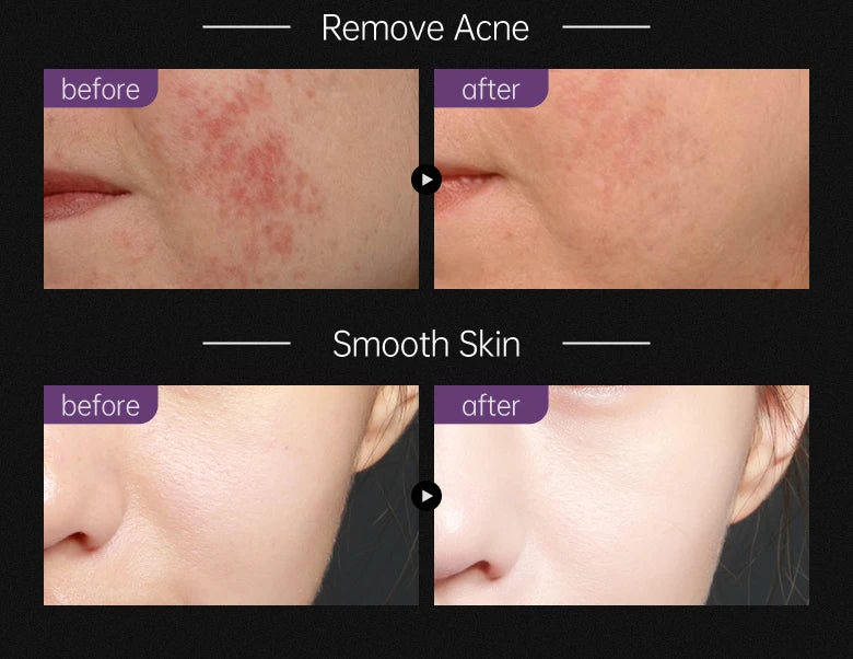 Black Head Remover Face Mask Bamboo Charcoal Black Dot T-zone Deep Cleaning for Women Men Blackhead Facial Skin Care Products