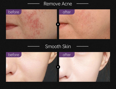 Black Head Remover Face Mask Bamboo Charcoal Black Dot T-zone Deep Cleaning for Women Men Blackhead Facial Skin Care Products