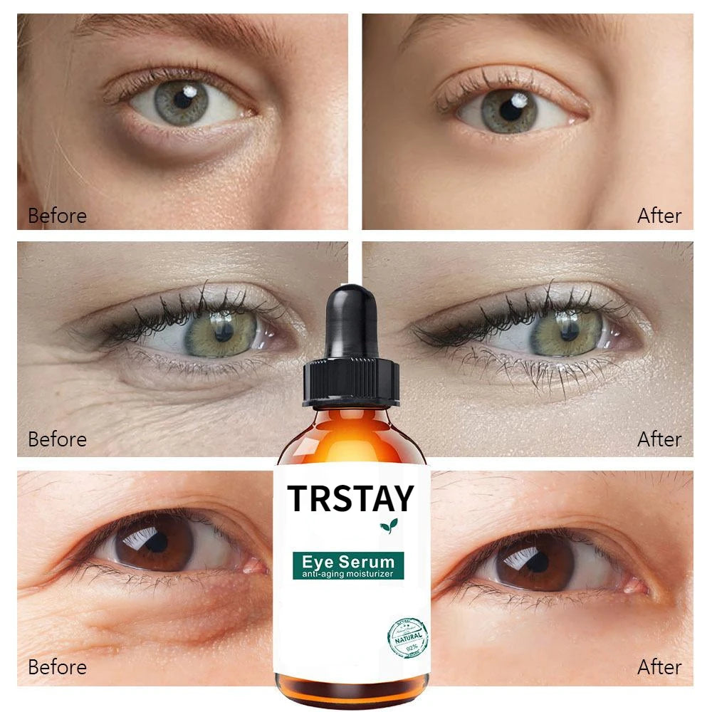 Retinol Anti-aging Whitening Oil Control  Eye Serum Gold Serum Korean Skin Care Products