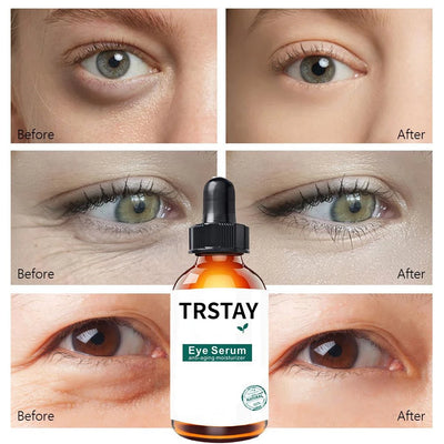 Retinol Anti-aging Whitening Oil Control  Eye Serum Gold Serum Korean Skin Care Products