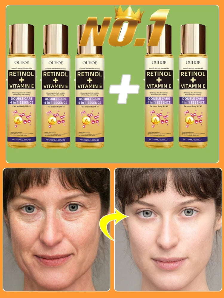 Wrinkles disappear permanently