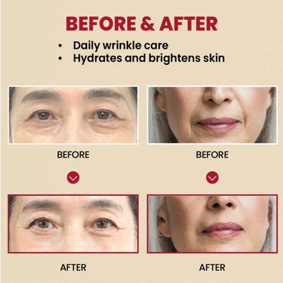 Seoul 1988 Anti-Aging Trio: 4% Retinal Eye Cream + 2% Retinal Serum w/ Black Ginseng for Wrinkles & Brightening,Korean Skincare