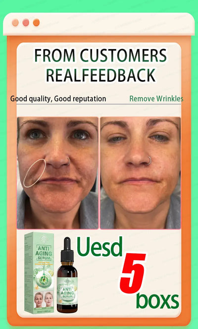 20 years younger，100% wrinkles disappear