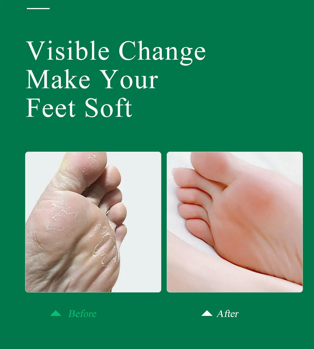 MABREM Foot Treatment Cream Whitening Anti-cracking Moisturizing Foot Care Exfoliating Scrub Anti-dry Calendula Olive Repair 40g