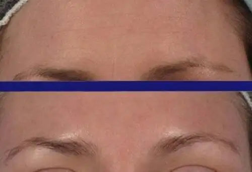 PURE RETINOL SERUM 5% HYALURONIC ACID RETINOL FACE CREAM 30ml Anti-aging Anti-wrinkle Exfoliate Skin Care Firming