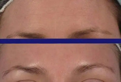 PURE RETINOL SERUM 5% HYALURONIC ACID RETINOL FACE CREAM 30ml Anti-aging Anti-wrinkle Exfoliate Skin Care Firming