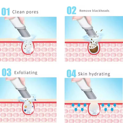 3 in 1 Blackhead Removal Facial Moisturizing Hydro Oxygen Spray Jet Peel Microdermabrasion Micro Bubble Machine