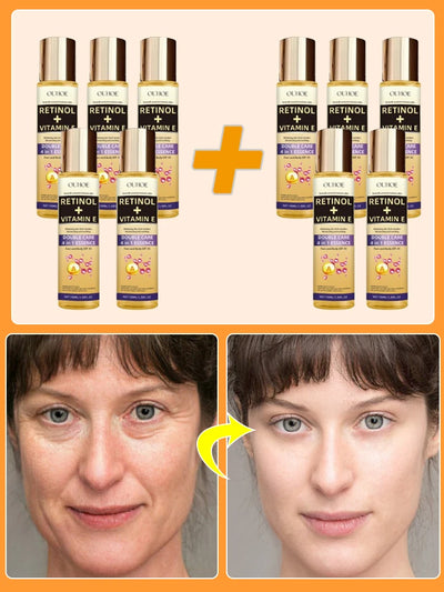 Wrinkles disappear permanently