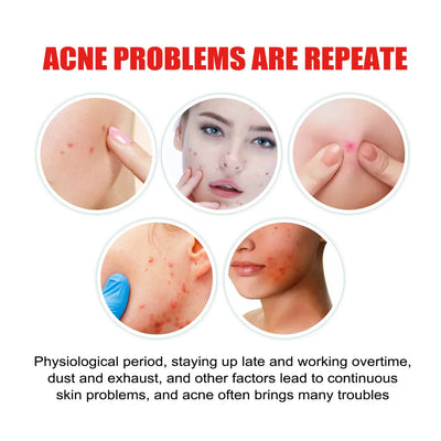 Repair Acne Patch Facial Skin Care Fade Blemishes Pimple Marks Closed Acne Blemishes Cover Acne Pimple Repair Patch