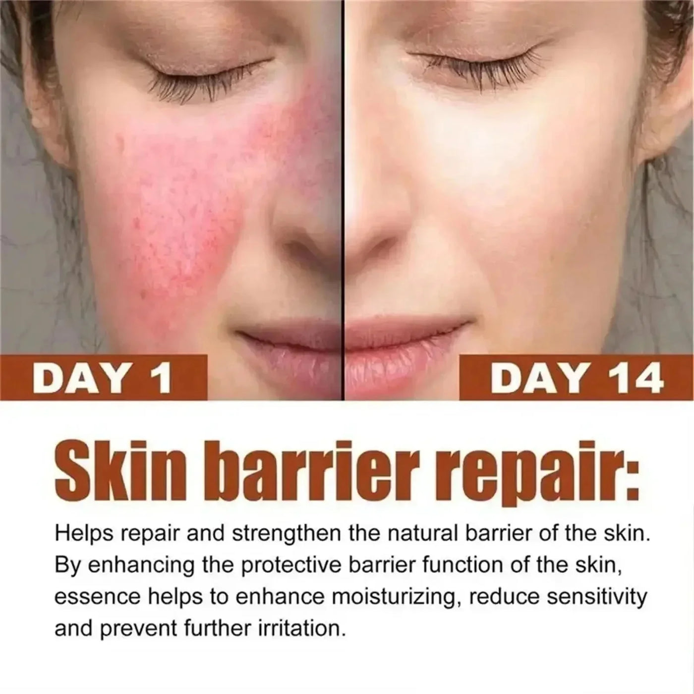 Fast Repair Facial Redness Essential oil Soothing Red Blood Rosacea Improve Sensitive Skin Dryness Moisturizing Korean Cosmetics