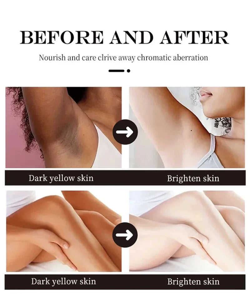 Whitening Cream Private Parts Underarm Bleaching Serum Whiten Butt Knee Brighten Inner Thigh Intimate Parts Dark Remove Melanin