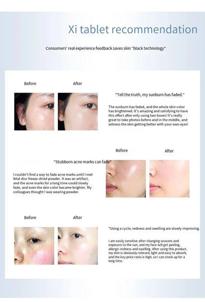 Polypeptide Placenta Freeze-dried Powder Essence Repair Facial Hydrating Nourishing Pore Shrinking Skin Rejuvenate Skin Care