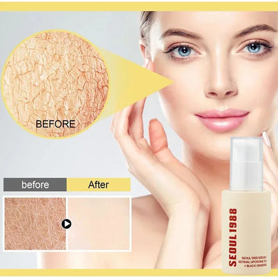 Seoul 1988 Eye Cream Niacinamide Retinoic Acid Ginseng Essence Firm Cream Lighten Fine Lines Deep Moisturizing Care Essence Set