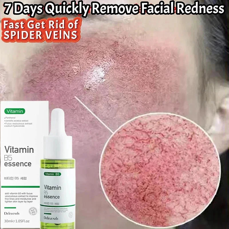 7 Day Repair Redness Serum Sooth Itching Sensitive Skin Improve Rosacea Shrink Pore Smooth Nourish Facial Skin Korean Cosmetics