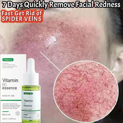 7 Day Repair Redness Serum Sooth Itching Sensitive Skin Improve Rosacea Shrink Pore Smooth Nourish Facial Skin Korean Cosmetics