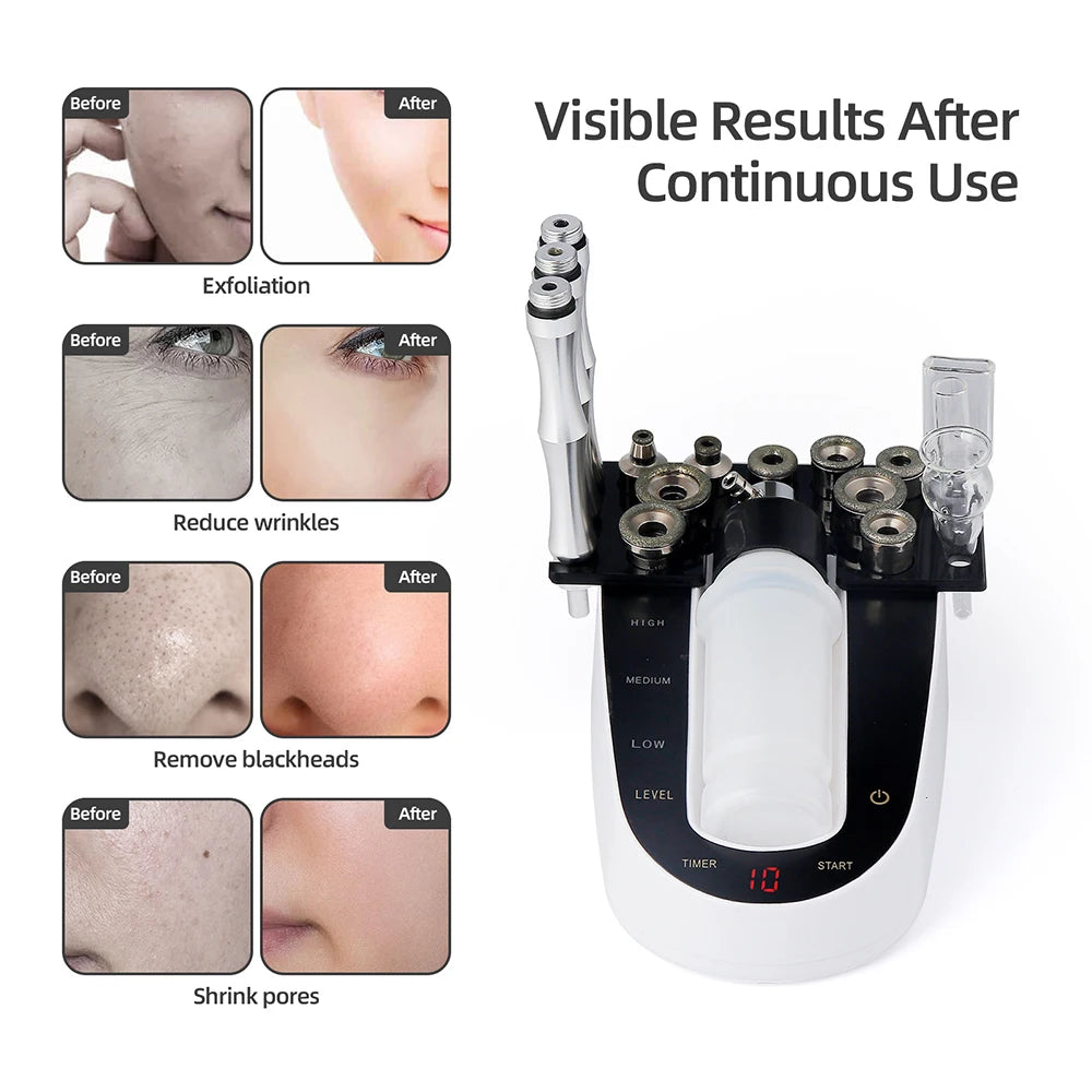 Professional Facial Diamond Microdermabrasion Machine Home Use Face Peeling Beauty Machine Exfoliation Pore Cleaning Skin Care