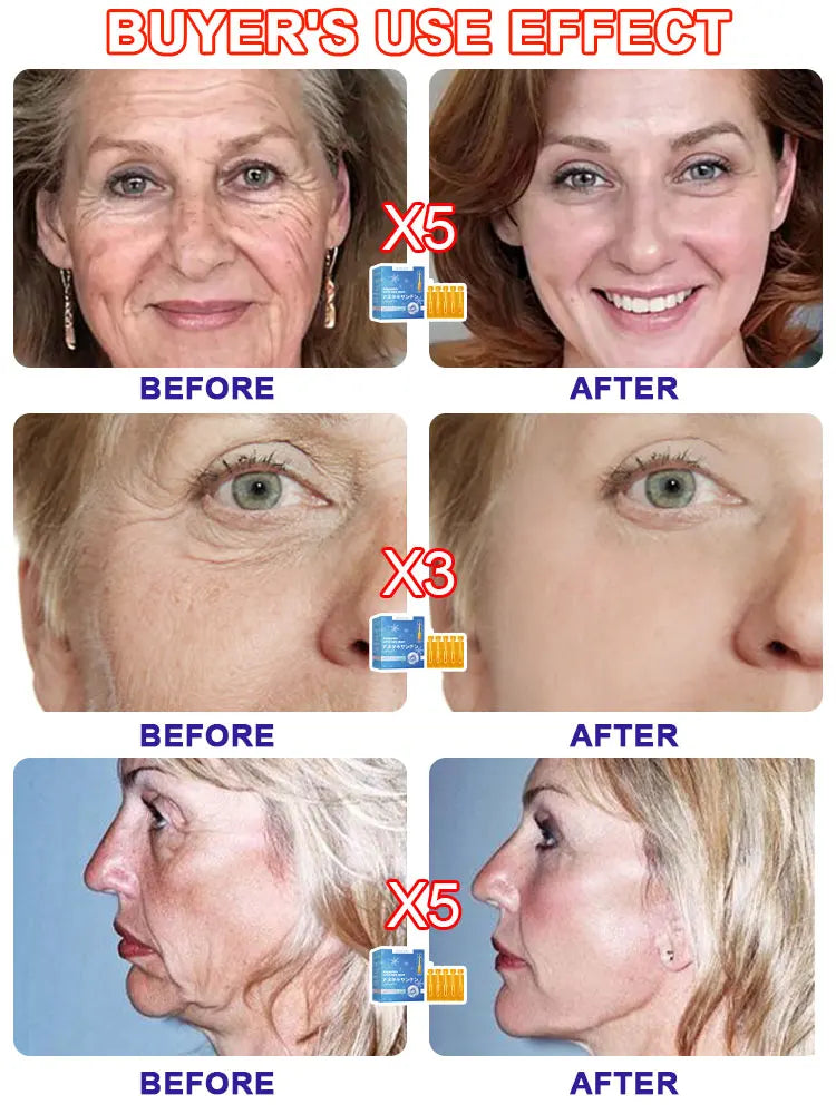 20 ʏᴇᴀʀs ʏᴏᴜɴɢᴇʀ! Aɴᴛɪ-ᴡʀɪɴᴋʟᴇ, ғɪʀᴍɪɴɢ, ʟɪɢʜᴛ ʟɪɴᴇs ʀᴇᴘᴀɪʀ